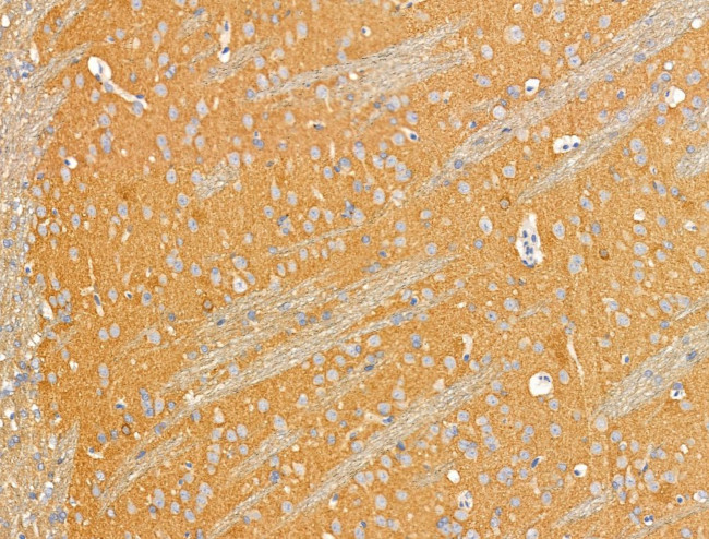 EDG2 Antibody in Immunohistochemistry (Paraffin) (IHC (P))