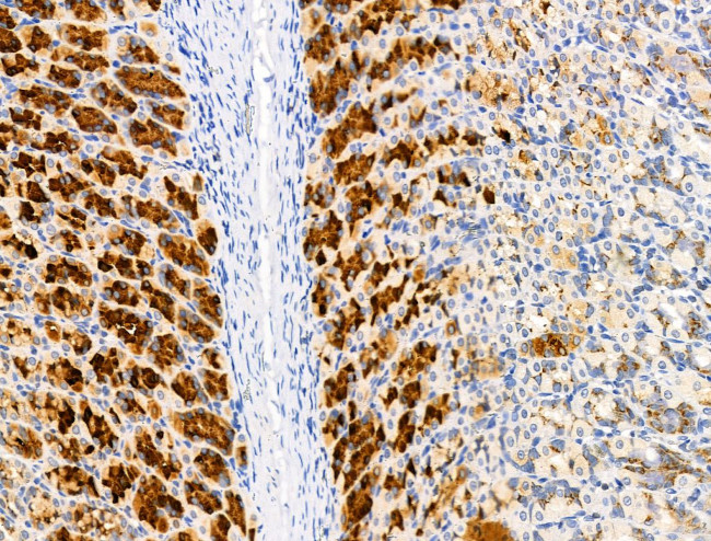 EDG2 Antibody in Immunohistochemistry (Paraffin) (IHC (P))