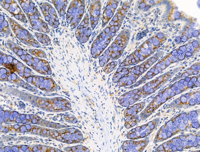 EDG2 Antibody in Immunohistochemistry (Paraffin) (IHC (P))