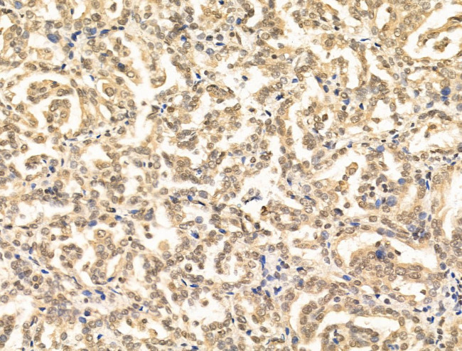 AP2 alpha Antibody in Immunohistochemistry (Paraffin) (IHC (P))