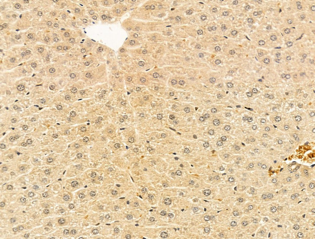 AP2 alpha Antibody in Immunohistochemistry (Paraffin) (IHC (P))