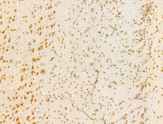 HDAC5 Antibody in Immunohistochemistry (Paraffin) (IHC (P))