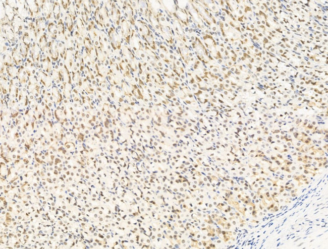 HDAC5 Antibody in Immunohistochemistry (Paraffin) (IHC (P))