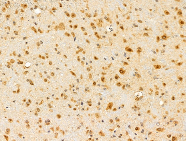 HDAC5 Antibody in Immunohistochemistry (Paraffin) (IHC (P))