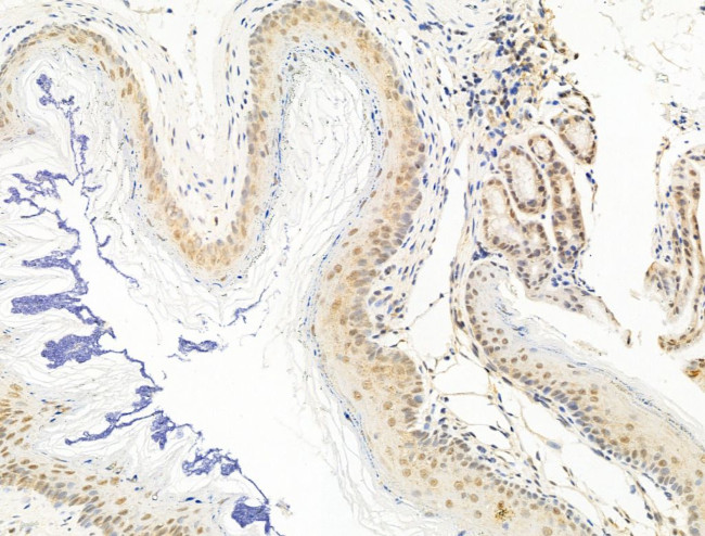 HDAC5 Antibody in Immunohistochemistry (Paraffin) (IHC (P))