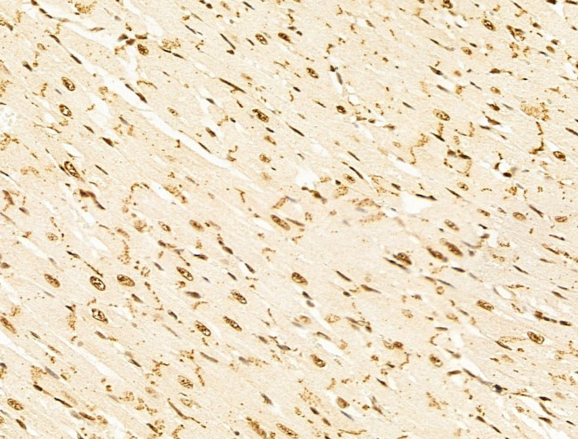 HDAC5 Antibody in Immunohistochemistry (Paraffin) (IHC (P))