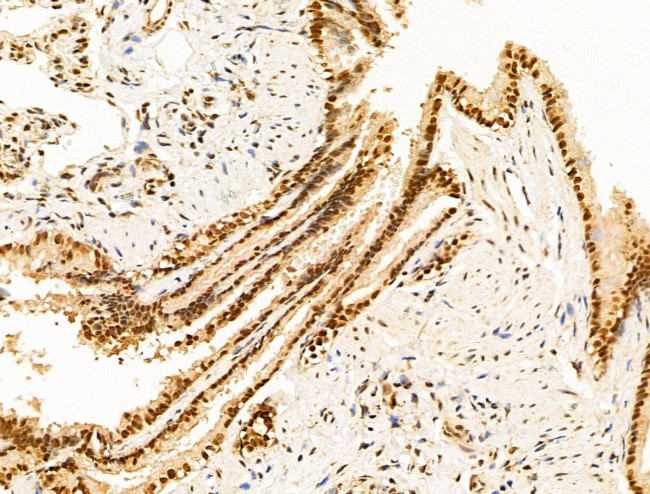 HDAC5 Antibody in Immunohistochemistry (Paraffin) (IHC (P))