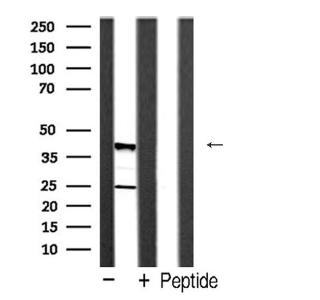 Caspase 4 Precursor (Cleaved Gln81) Antibody in Western Blot (WB)