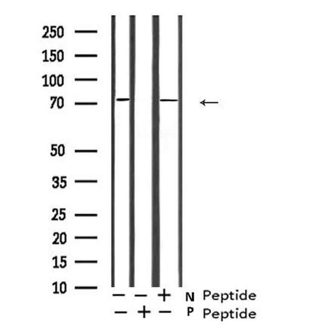 Phospho-GAB2 (Ser623) Antibody in Western Blot (WB)