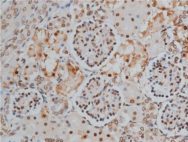 Phospho-MYPT1 (Thr853) Antibody in Immunohistochemistry (Paraffin) (IHC (P))