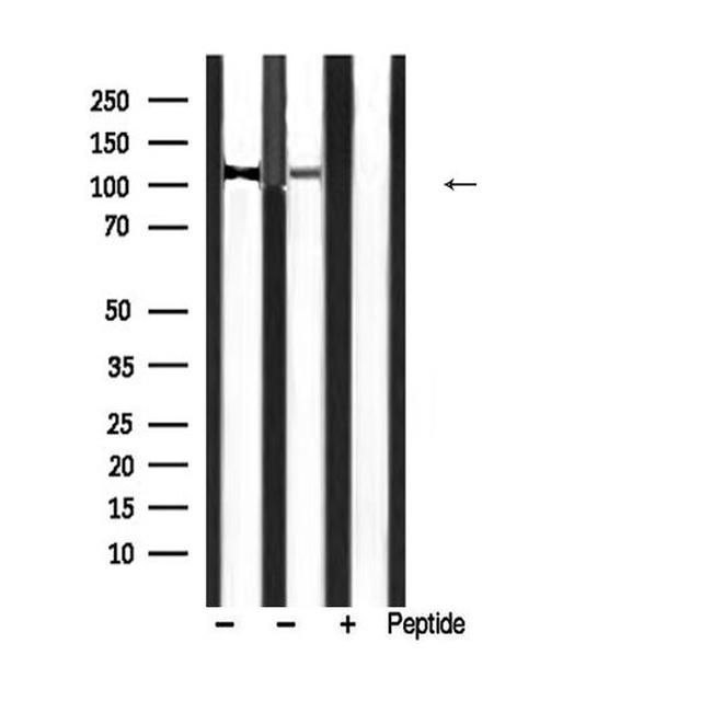 Phospho-MYPT1 (Thr853) Antibody in Western Blot (WB)