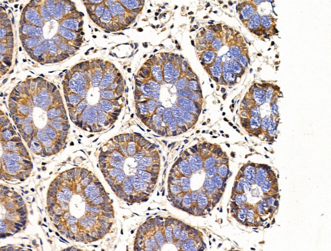 SIAH2 Antibody in Immunohistochemistry (Paraffin) (IHC (P))