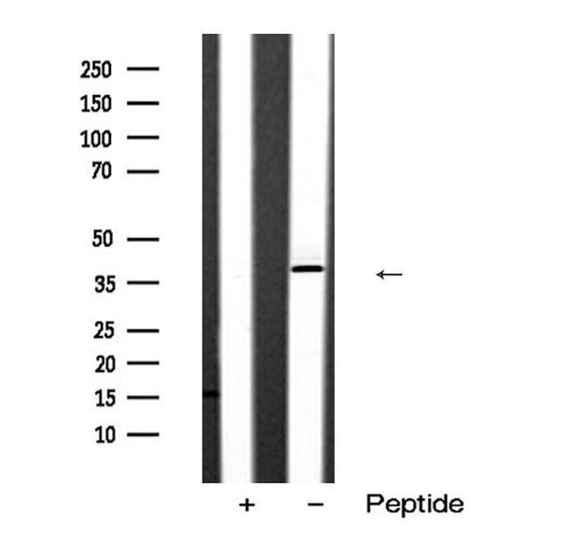 SIAH2 Antibody in Western Blot (WB)