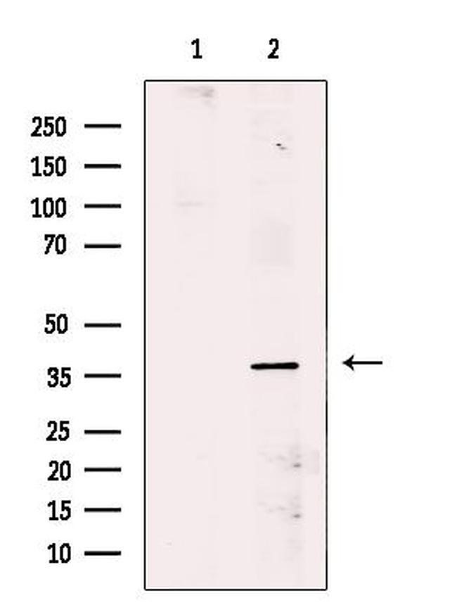 SIAH2 Antibody in Western Blot (WB)