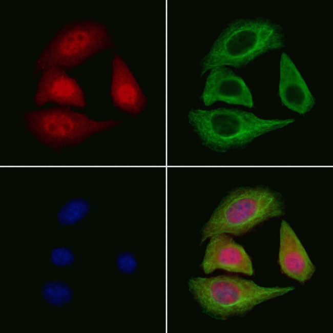 IKK alpha/beta Antibody in Immunocytochemistry (ICC/IF)