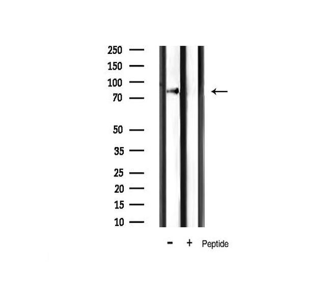 IKK alpha/beta Antibody in Western Blot (WB)