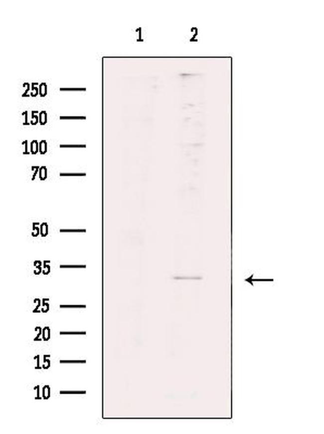 MARCKS Antibody in Western Blot (WB)