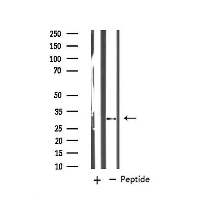 MARCKS Antibody in Western Blot (WB)