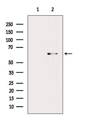 AMPK alpha Antibody in Western Blot (WB)