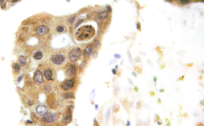 HDAC5 Antibody in Immunohistochemistry (Paraffin) (IHC (P))