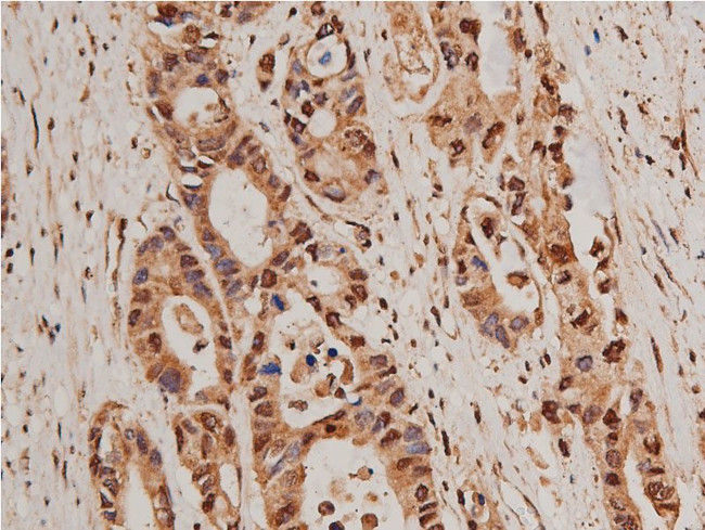 HDAC5 Antibody in Immunohistochemistry (Paraffin) (IHC (P))