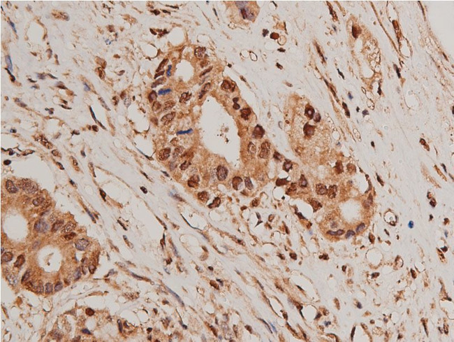 HDAC5 Antibody in Immunohistochemistry (Paraffin) (IHC (P))