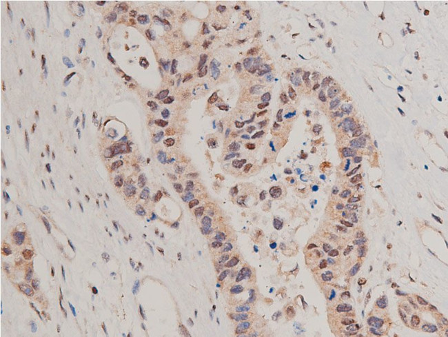 HDAC5 Antibody in Immunohistochemistry (Paraffin) (IHC (P))