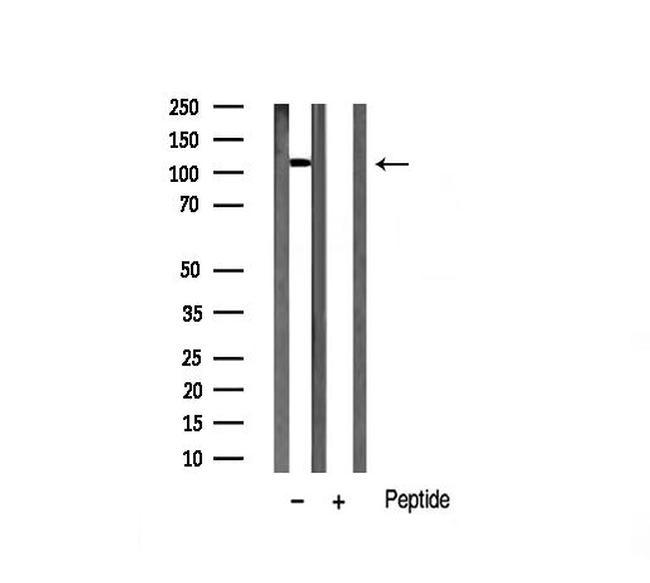 HDAC5 Antibody in Western Blot (WB)