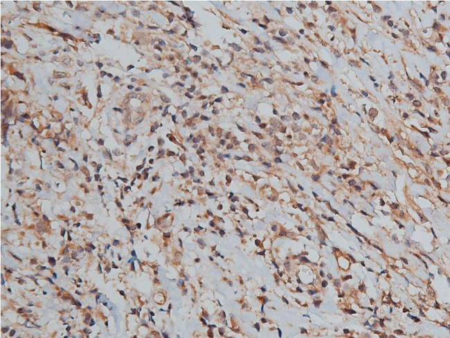 TIMP2 Antibody in Immunohistochemistry (Paraffin) (IHC (P))