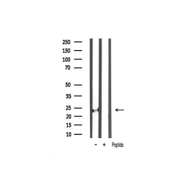 TIMP2 Antibody in Western Blot (WB)