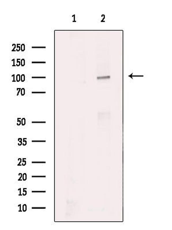 ROR1 Antibody in Western Blot (WB)