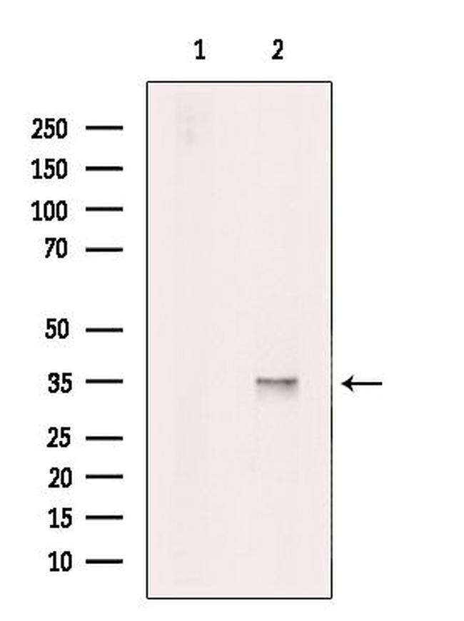 PRPS1 Antibody in Western Blot (WB)