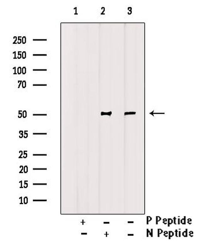 Phospho-GDF9 (Tyr394) Antibody in Western Blot (WB)