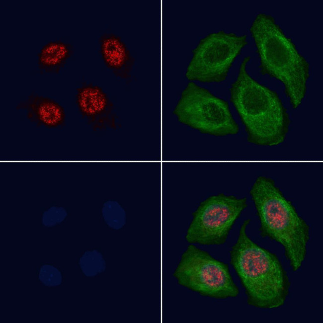 Phospho-SKI (Ser383) Antibody in Immunocytochemistry (ICC/IF)