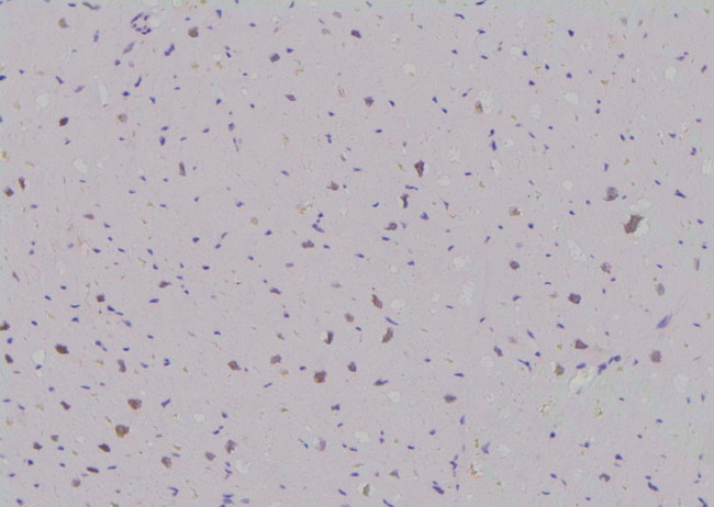 Phospho-SKI (Ser383) Antibody in Immunohistochemistry (Paraffin) (IHC (P))