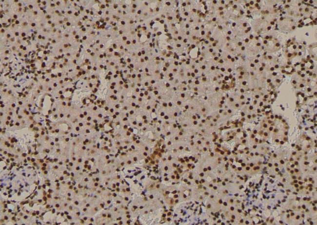 Phospho-CTGF (Ser118) Antibody in Immunohistochemistry (Paraffin) (IHC (P))