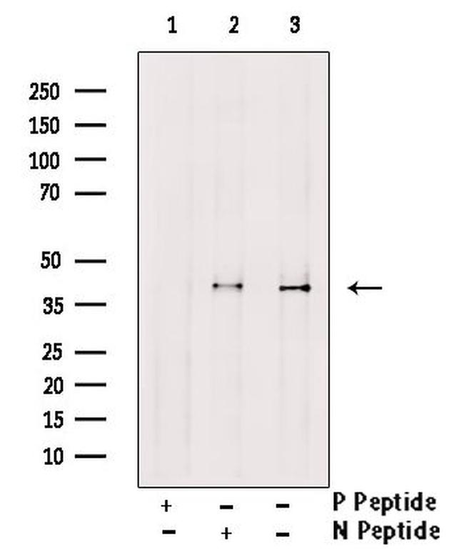 Phospho-CTGF (Ser118) Antibody in Western Blot (WB)