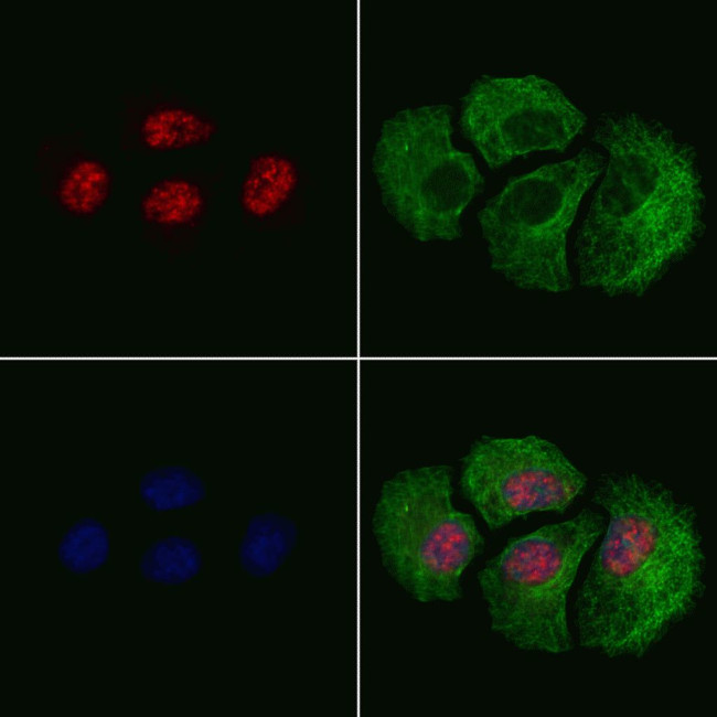 Phospho-Cullin 4A (Ser40) Antibody in Immunocytochemistry (ICC/IF)