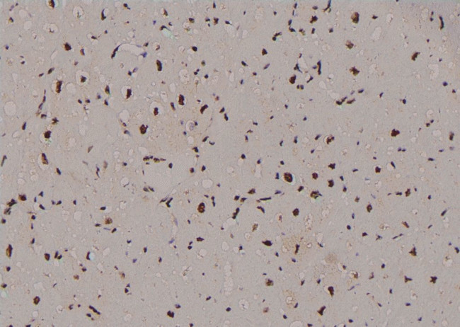 Phospho-Cullin 4A (Ser40) Antibody in Immunohistochemistry (Paraffin) (IHC (P))