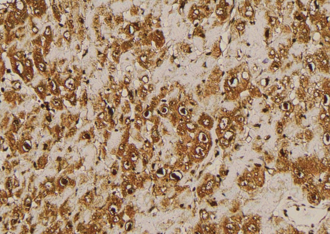 Phospho-KISS1R (Ser368) Antibody in Immunohistochemistry (Paraffin) (IHC (P))