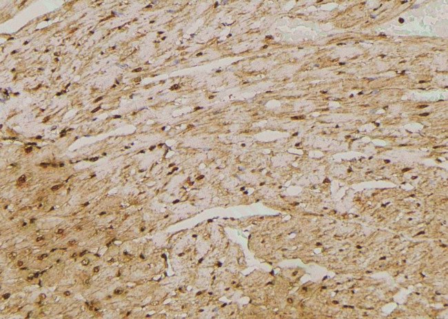 Phospho-KISS1R (Ser368) Antibody in Immunohistochemistry (Paraffin) (IHC (P))