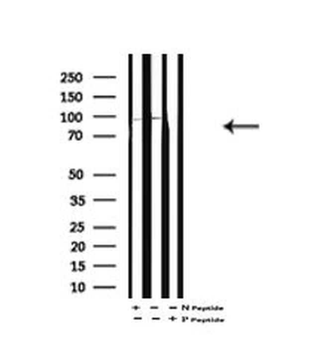 Phospho-HCN1 (Ser846) Antibody in Western Blot (WB)