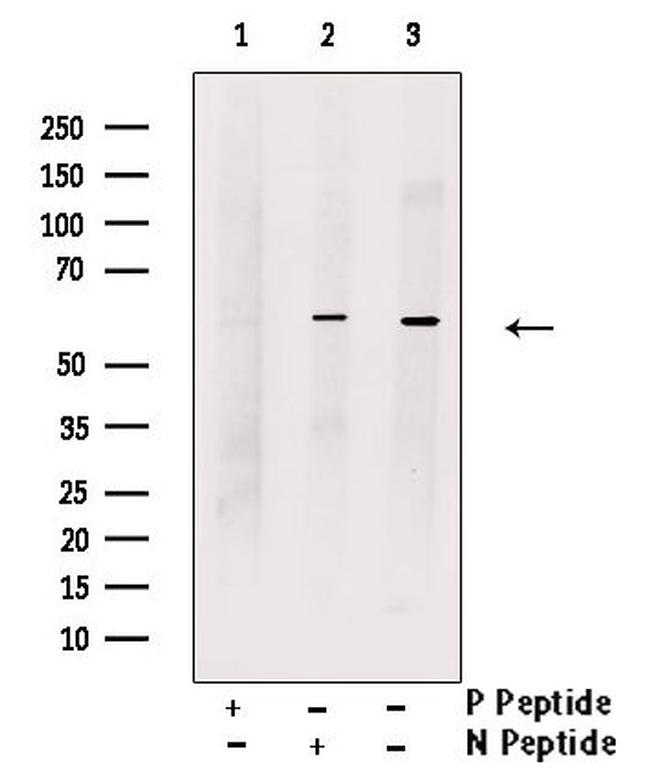Phospho-KV1.1 (KCNA1) (Ser446) Antibody in Western Blot (WB)