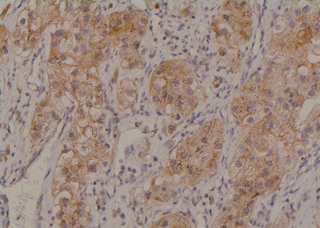 Phospho-MCT1 (Ser213) Antibody in Immunohistochemistry (Paraffin) (IHC (P))