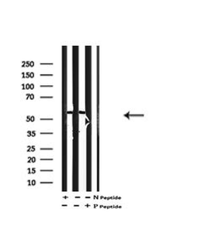 Phospho-MCT1 (Ser213) Antibody in Western Blot (WB)