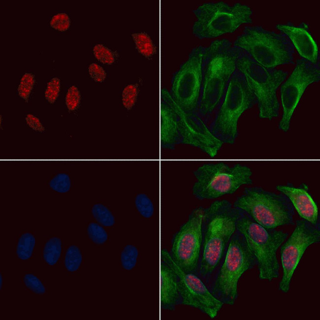 Phospho-HNF1A (Ser247) Antibody in Immunocytochemistry (ICC/IF)