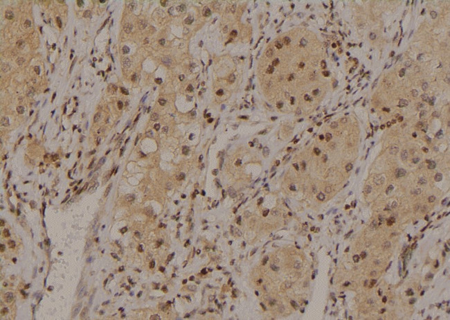 Phospho-HNF1A (Ser247) Antibody in Immunohistochemistry (Paraffin) (IHC (P))