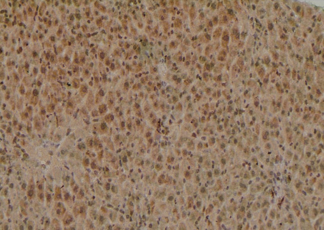 Phospho-HNF1A (Ser247) Antibody in Immunohistochemistry (Paraffin) (IHC (P))