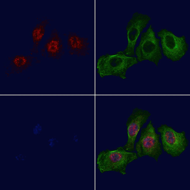 Phospho-Nkx2.1 (Ser23) Antibody in Immunocytochemistry (ICC/IF)