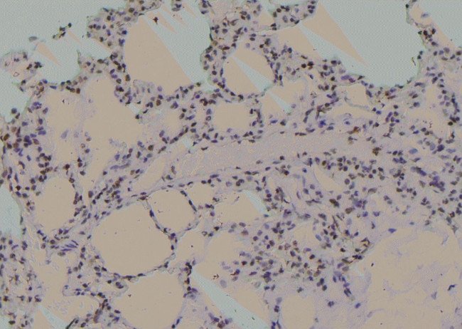 Phospho-Nkx2.1 (Ser23) Antibody in Immunohistochemistry (Paraffin) (IHC (P))